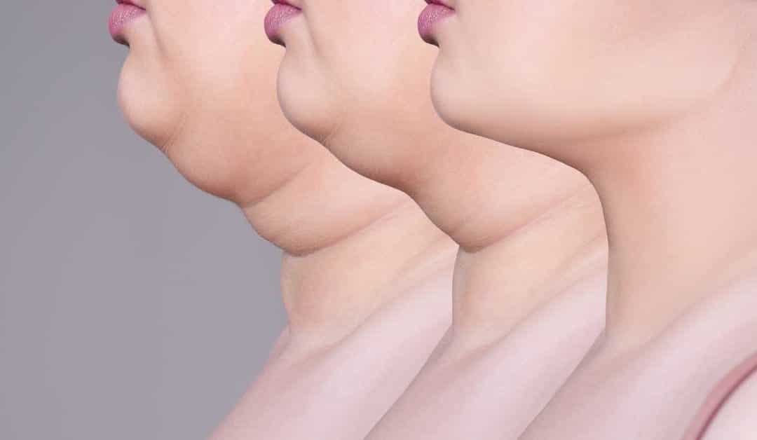 How To Reduce Double Chin Fat