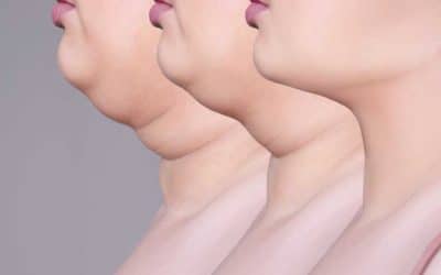 How To Reduce Double Chin Fat